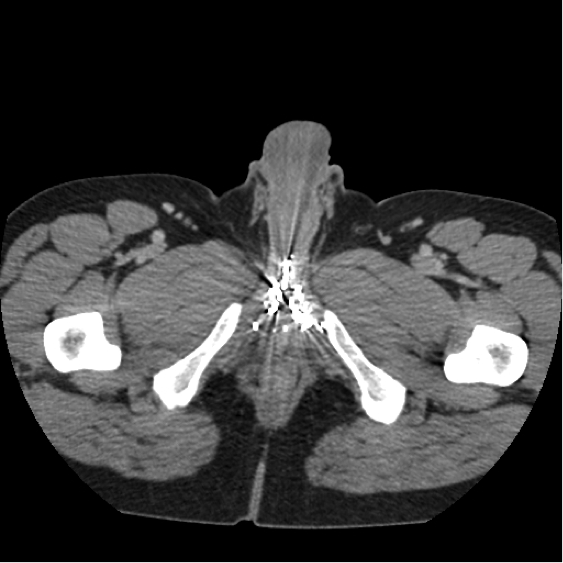 Arterio 2
