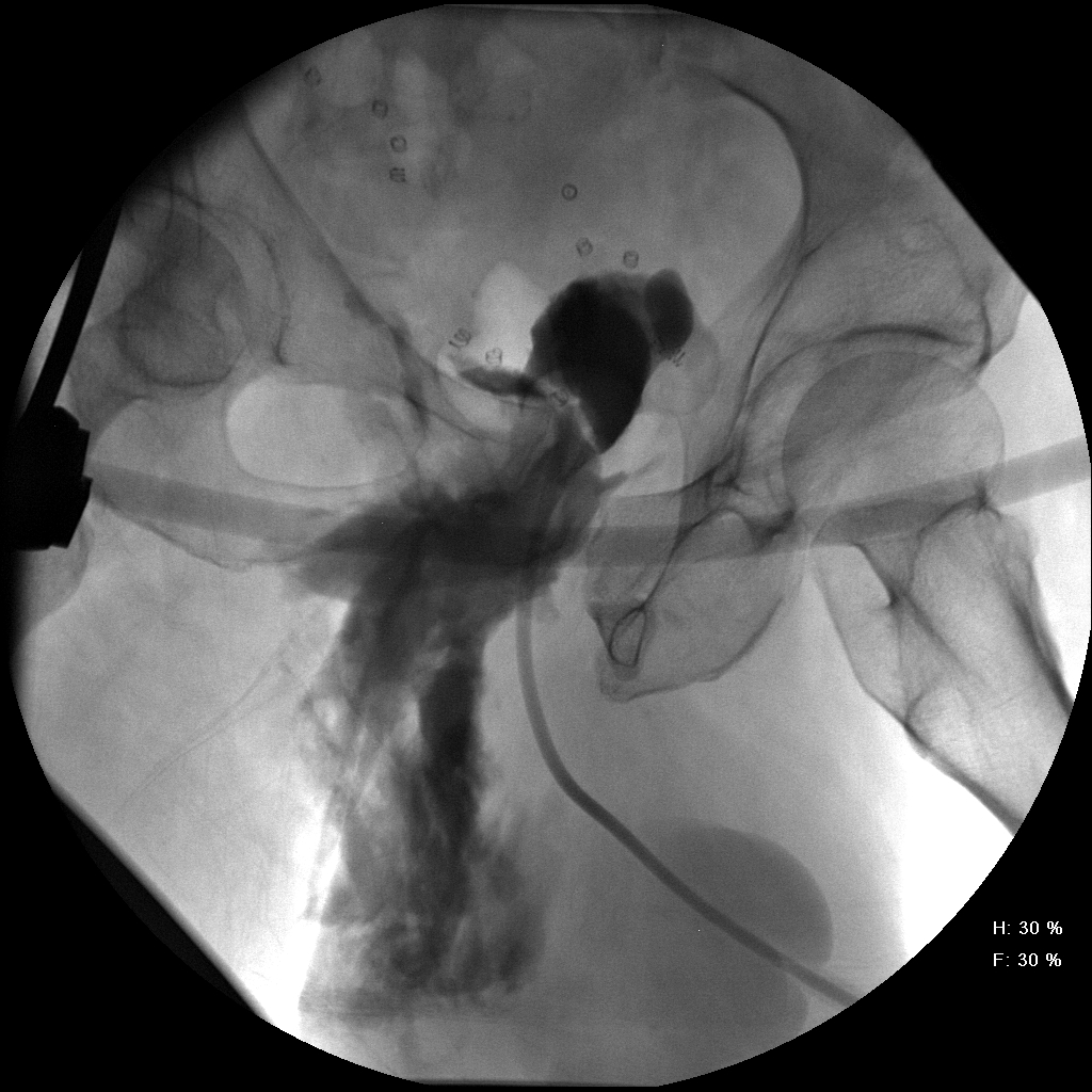 Cystogram EP