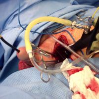 Lower Urinary Tract Trauma - Part 2 Image